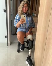 Woman Lost Leg, Fingers And Toes After Op